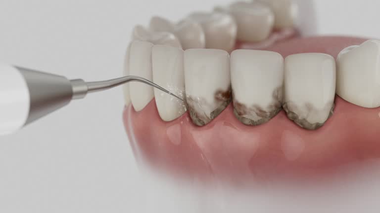 Reliable Emergency Dentist contractor in Freedom, CA by Smile Center Dentistry